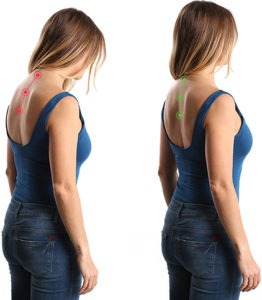 exercises to help with your posture - Home Physio Group