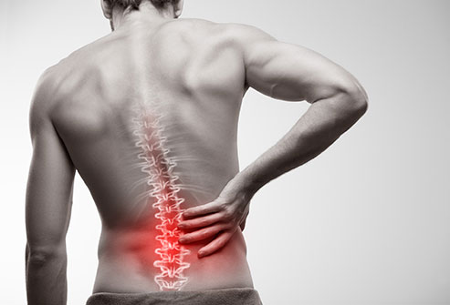 exercises to treat back pain - Home Physio Group