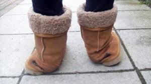 uggs-causing-foot-pain